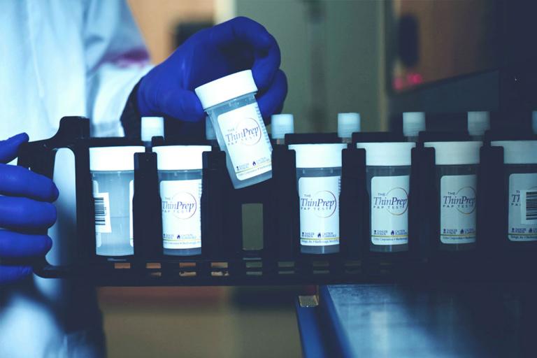 Gloved hand taking specimen out from tray